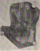 FINGERS BENT LATERALLY