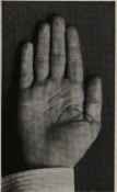 FINGERS NORMAL IN LENGTH