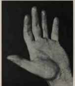 HERR MORIZ ROSENTHAL, THE HUNGARIAN PIANO VIRTUOSO