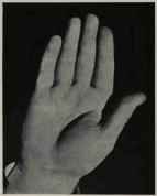 LARGE MOUNT OF VENUS