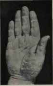 SHORT FINGERS