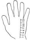The Age Of The Subject Age As Indicated On The Lin 179