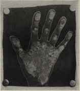 UPPER MOUNT OF MARS DEFICIENT