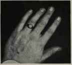 WRESTLER'S HAND