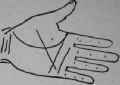A Line Cutting The Root Of The Second Finger 345