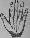 IX The Idiot s Hand 40