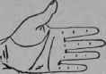 Laryngitis 162