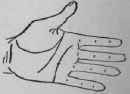 Oppression Of The Heart Consequence Of A Severe Li 707