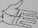 Oppression Of The Heart Consequence Of A Severe Li 710
