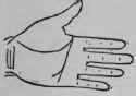 The Line Of Head IV Termination Forks At The Termi 548