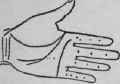 The Line Of Head IV Termination Forks At The Termi 554