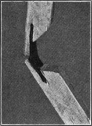 Detail Of Knee Joint