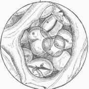 Bean Starch lying in Cellular Tissue, magnified 200 diameters.