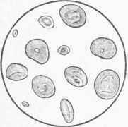 Wheat Starch, magnified 225 diameters.