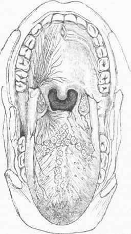 The mouth widely open, showing the tongue below.