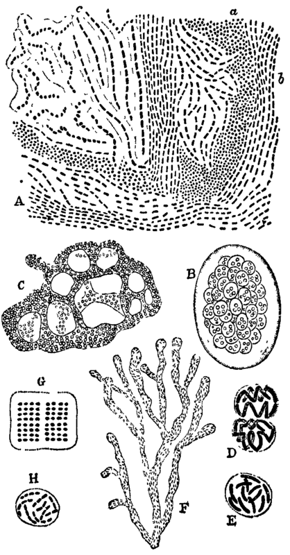 Fig. 3. Types of Zoogloea.
