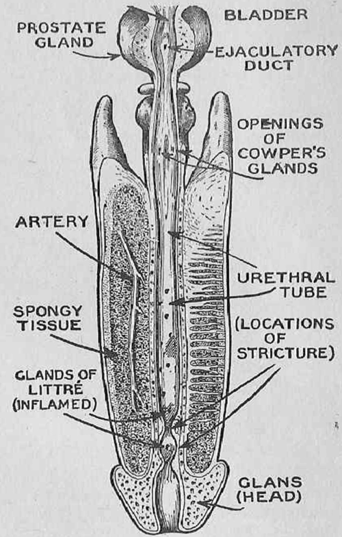Cross sectional view of the urethrathe outlet of the bladder  showing how (in the male) its flow is controlled by the prostate gland.