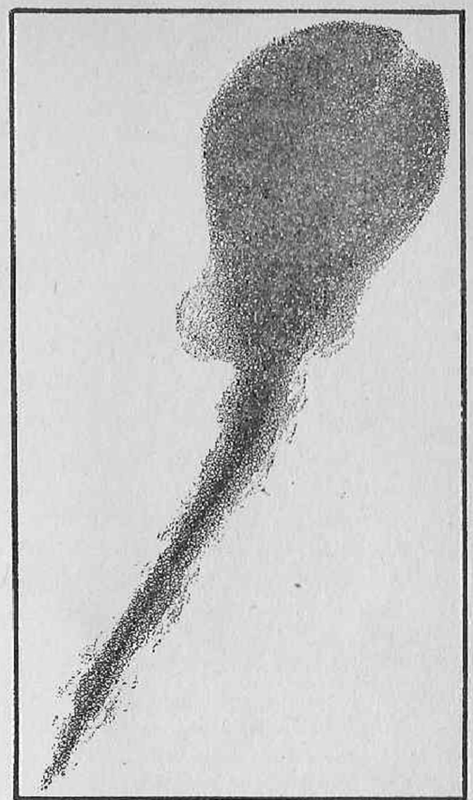 Magnification of this by 10,000 means that it is shown a trillion times life size The hundred billion chromosomes of the next human generation could be packed in an aspirin size tablet.