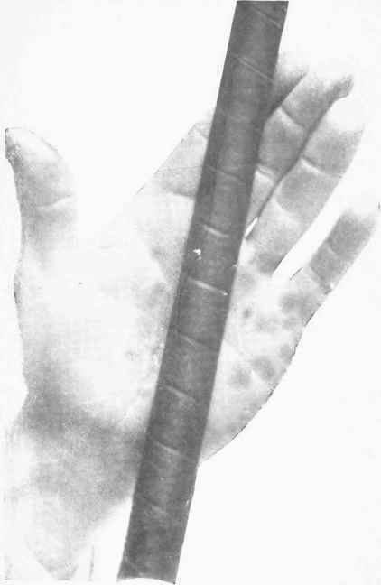 Fig. 15.   The line of the shall across the left hand when the hand is opened after gripping the club as in Fig. 16.